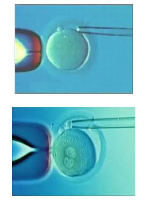 扬州试管助孕视频技术解析