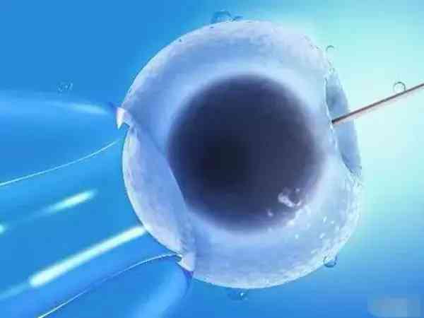 手淫与男性不育症相关性研究